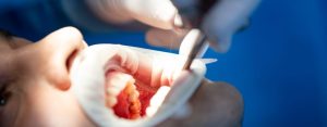 Pacient in dental clinic while operation